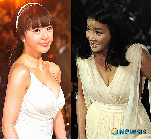 성형 미인이 된 연예인